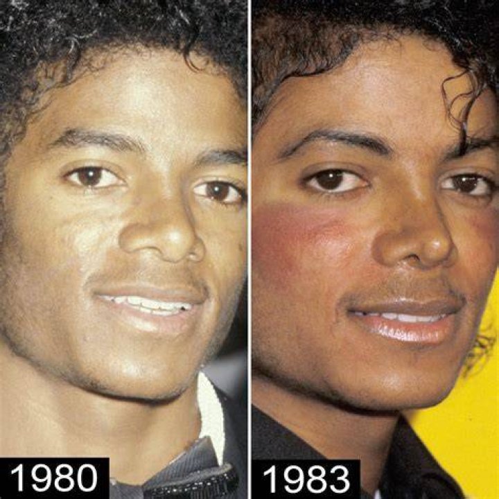 How Much Plastic Surgery Did Michael Jackson Have Done? Watch His Face Transform Over Time